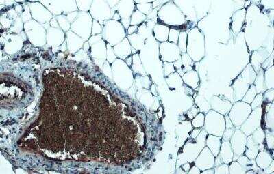 Immunohistochemistry-Paraffin: Lipoprotein Lipase/LPL Antibody [NBP1-32215]