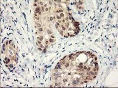 Immunohistochemistry: Lipoprotein Lipase/LPL Antibody (OTI3A10) - Azide and BSA Free [NBP2-71178]