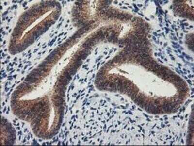 Immunohistochemistry: Lipoprotein Lipase/LPL Antibody (OTI3A10) - Azide and BSA Free [NBP2-71178]