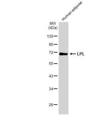 Western Blot: Lipoprotein Lipase/LPL Antibody [NBP1-32215]