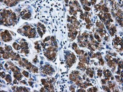 Immunohistochemistry-Paraffin: Livin Antibody (OTI1D12) [NBP2-02177]