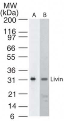 Western Blot: Livin Antibody (88C570)Azide Free [NBP2-33225]