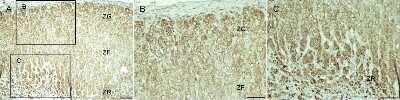 Immunohistochemistry-Paraffin: Livin Antibody [NB100-56145]
