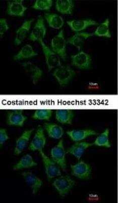 Immunocytochemistry/ Immunofluorescence: Loricrin Antibody [NBP1-33610]