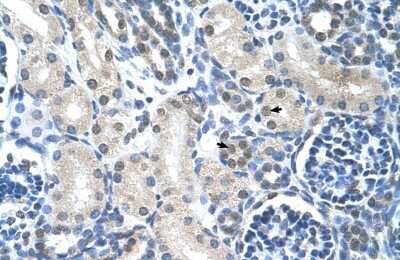 Immunohistochemistry-Paraffin: Loricrin Antibody [NBP1-55127]