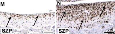 Immunohistochemistry: Lubricin/PRG4 Antibody [NBP1-19048]