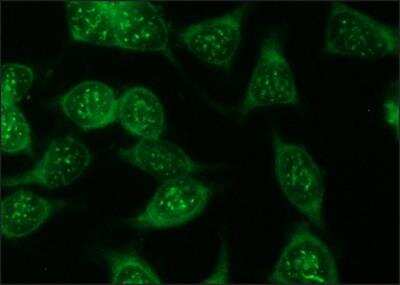 Immunocytochemistry/ Immunofluorescence: Luciferase Antibody [NB110-17348]