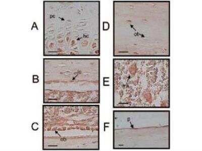 Immunohistochemical Staining of Luciferase in Paraffin Embedded Mouse Tibias