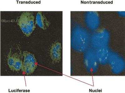 Immunohistochemistry: Luciferase Antibody (Luci 21 1-107) - BSA Free [NB600-307]