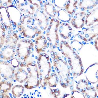 Immunohistochemistry-Paraffin: Lumican Antibody (4Z2C1) [NBP3-15408]