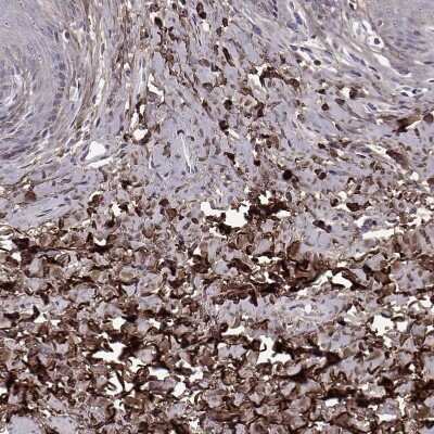 Immunohistochemistry-Paraffin: Lumican Antibody [NBP1-87726]