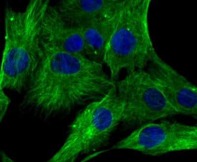 Immunocytochemistry/ Immunofluorescence: Lumican Antibody (JE11-45) [NBP2-76847]