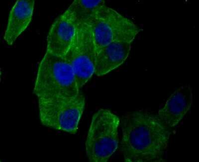 Immunocytochemistry/ Immunofluorescence: Lumican Antibody (JE11-45) [NBP2-76847]