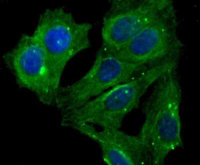 Immunocytochemistry/ Immunofluorescence: Lumican Antibody (JE11-45) [NBP2-76847]