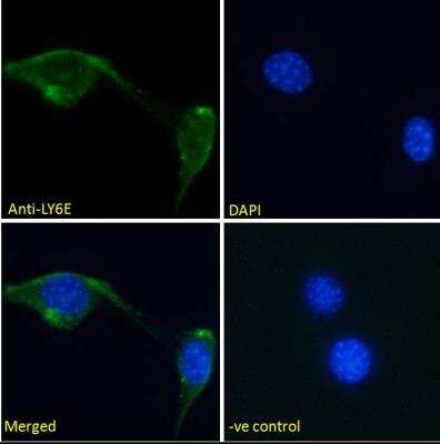 Immunocytochemistry/ Immunofluorescence: Ly-6E Antibody [NBP1-52176]