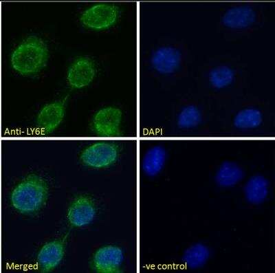 Immunocytochemistry/ Immunofluorescence: Ly-6E Antibody [NBP1-52176]