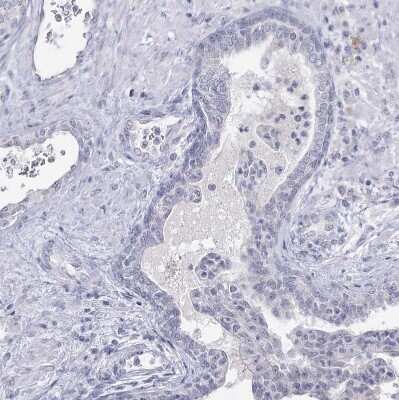 Immunohistochemistry: Ly-6G5C Antibody [NBP1-91160]