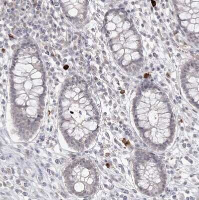 Immunohistochemistry-Paraffin: Ly-6G5C Antibody [NBP1-91160]