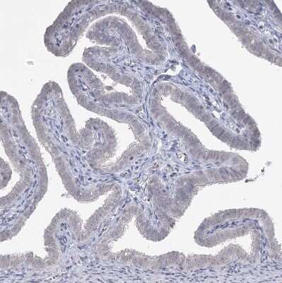 Immunohistochemistry-Paraffin: Ly-6G5C Antibody [NBP1-91160]