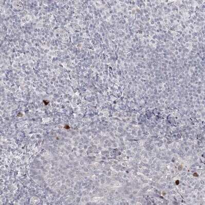 Immunohistochemistry-Paraffin: Ly-6G5C Antibody [NBP1-91160]