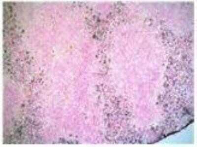 Immunohistochemistry-Frozen: Ly-6G/Ly-6C Antibody (NIMP-R14) [NB600-1387]