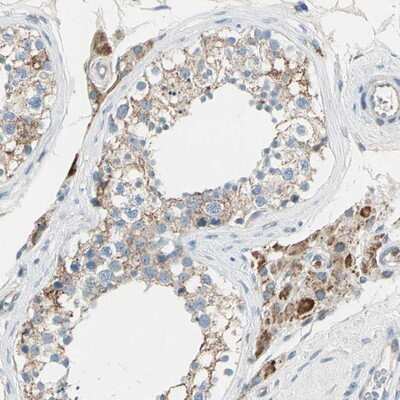 Immunohistochemistry-Paraffin: Ly-6G6F Antibody [NBP1-86749]