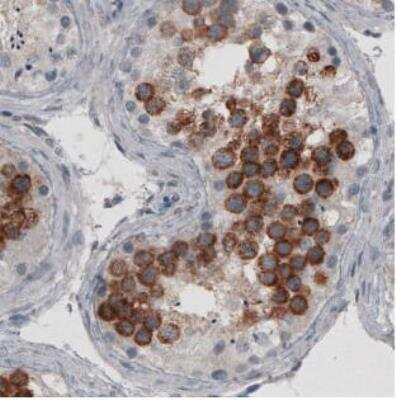 Immunohistochemistry-Paraffin: Ly6K Antibody (CL2433) [NBP2-36763]