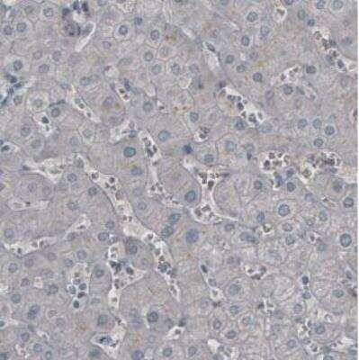 Immunohistochemistry-Paraffin: Ly6K Antibody (CL2433) [NBP2-36763]