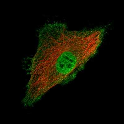Immunocytochemistry/ Immunofluorescence: Ly6K Antibody (CL2435) [NBP2-36764]