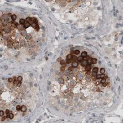 Immunohistochemistry-Paraffin: Ly6K Antibody (CL2435) [NBP2-36764]