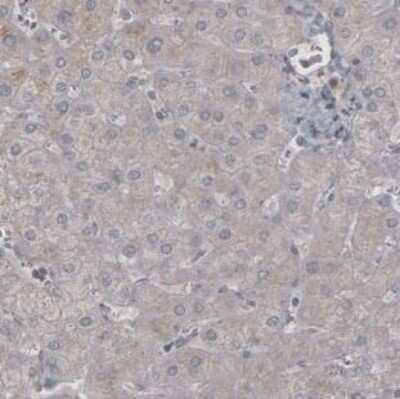 Immunohistochemistry-Paraffin: Ly6K Antibody (CL2435) [NBP2-36764]