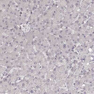 Immunohistochemistry-Paraffin: Ly6K Antibody [NBP1-84340]