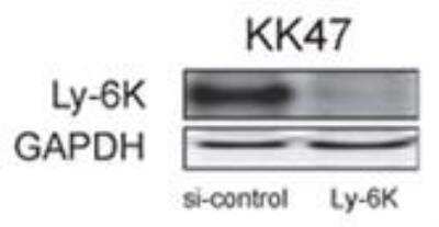 Western Blot: Ly6K AntibodyBSA Free [NBP2-24405]