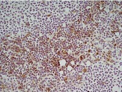 Immunohistochemistry: Ly-6C Antibody (ER-MP20) - BSA Free [NB100-65413]