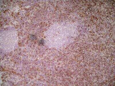 Immunohistochemistry: Ly-6C Antibody (ER-MP20) - BSA Free [NB100-65413]