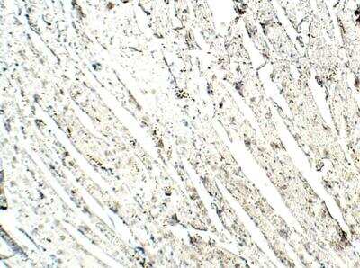 Immunohistochemistry-Paraffin: Lymphocyte Expansion Molecule Antibody [NBP3-12323]