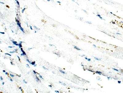 Immunohistochemistry-Paraffin: Lymphocyte Expansion Molecule Antibody [NBP3-12323]