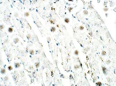 Immunohistochemistry-Paraffin: Lymphocyte Expansion Molecule Antibody [NBP3-12323]