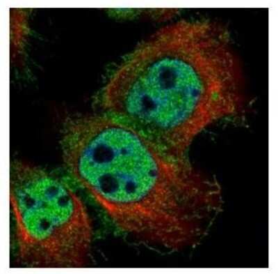 Immunocytochemistry/ Immunofluorescence: Lyn Antibody [NBP2-17188]