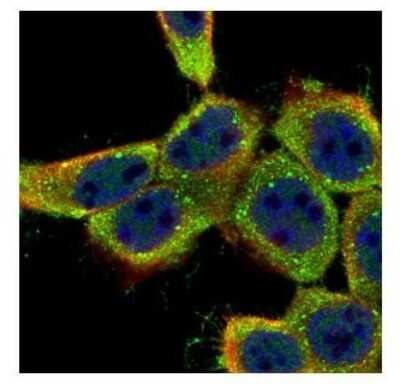 Immunocytochemistry/ Immunofluorescence: Lyn Antibody [NBP2-17189]