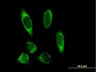 Immunocytochemistry/ Immunofluorescence: Lysine Hydroxylase 2/PLOD2 Antibody [H00005352-B01P]