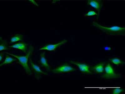 Immunocytochemistry/ Immunofluorescence: Lysine Hydroxylase 2/PLOD2 Antibody [H00005352-D01P]