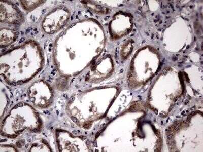 Immunohistochemistry: Lysine Hydroxylase 2/PLOD2 Antibody (OTI6D1) - Azide and BSA Free [NBP2-72556]