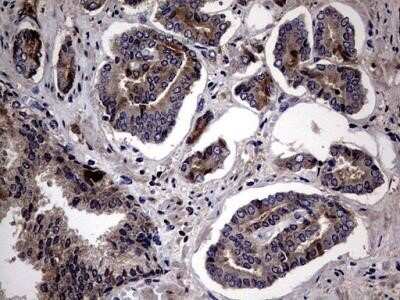 Immunohistochemistry: Lysine Hydroxylase 2/PLOD2 Antibody (OTI6D1) - Azide and BSA Free [NBP2-72556]