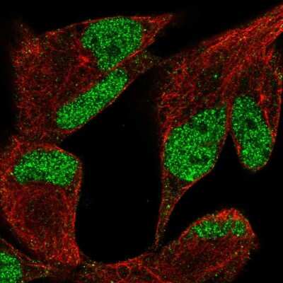 Immunocytochemistry/ Immunofluorescence: Lysine (K)-specific Demethylase 3A/KDM3A/JMJD1A Antibody [NBP2-56228]