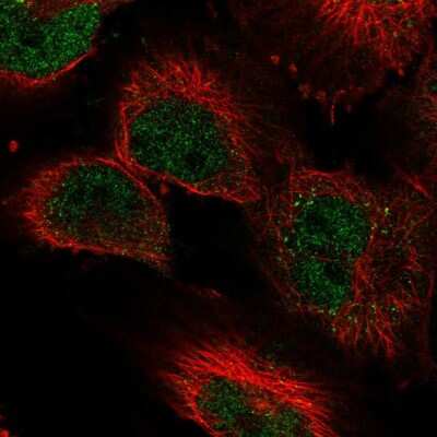 Immunocytochemistry/ Immunofluorescence: Lysine (K)-specific Demethylase 3A/KDM3A/JMJD1A Antibody [NBP2-56254]
