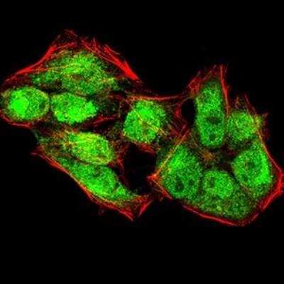 Immunocytochemistry/ Immunofluorescence: Lysine (K)-specific Demethylase 4A/KDM4A/JMJD2A Antibody (6E10G4) - BSA Free [NBP2-52499]