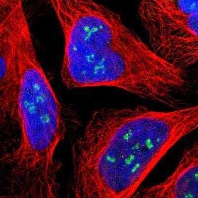 Immunocytochemistry/ Immunofluorescence: Lysine (K)-specific Demethylase 4A/KDM4A/JMJD2A Antibody [NBP1-87855]