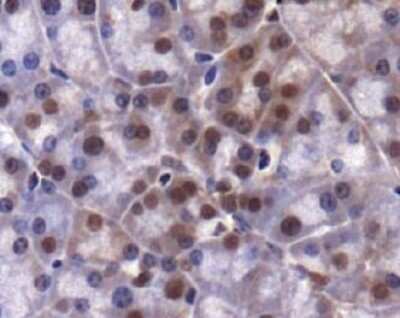 Immunohistochemistry: Lysine (K)-specific Demethylase 4A/KDM4A/JMJD2A Antibody - BSA Free [NBP1-49602]