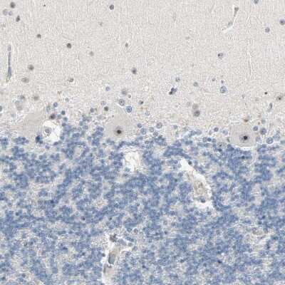 Immunohistochemistry-Paraffin: Lysine (K)-specific Demethylase 4A/KDM4A/JMJD2A Antibody [NBP1-87855]